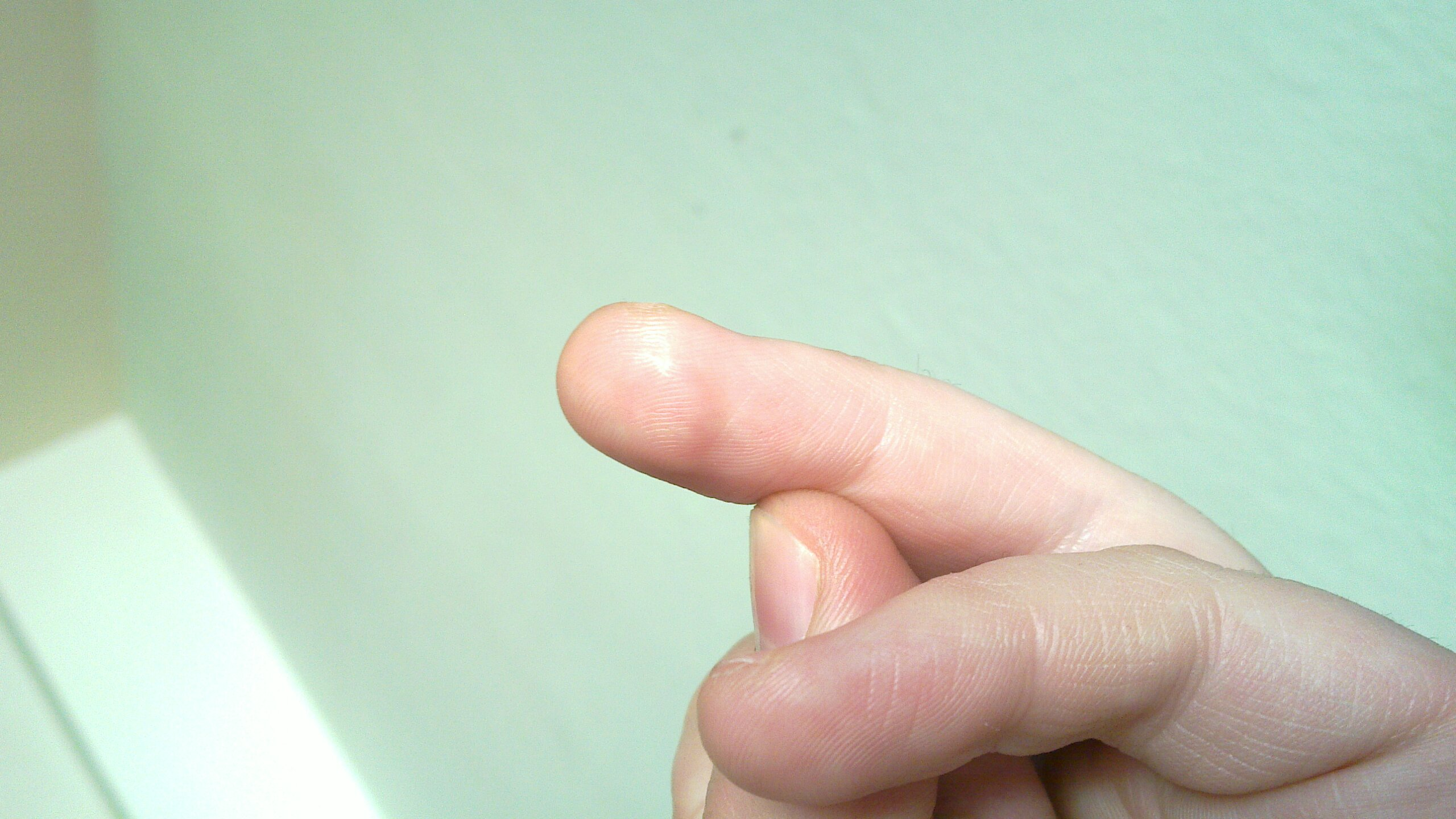 The scar is mostly visible as a little part of skin that reflects more light than the rest of the fingertip.